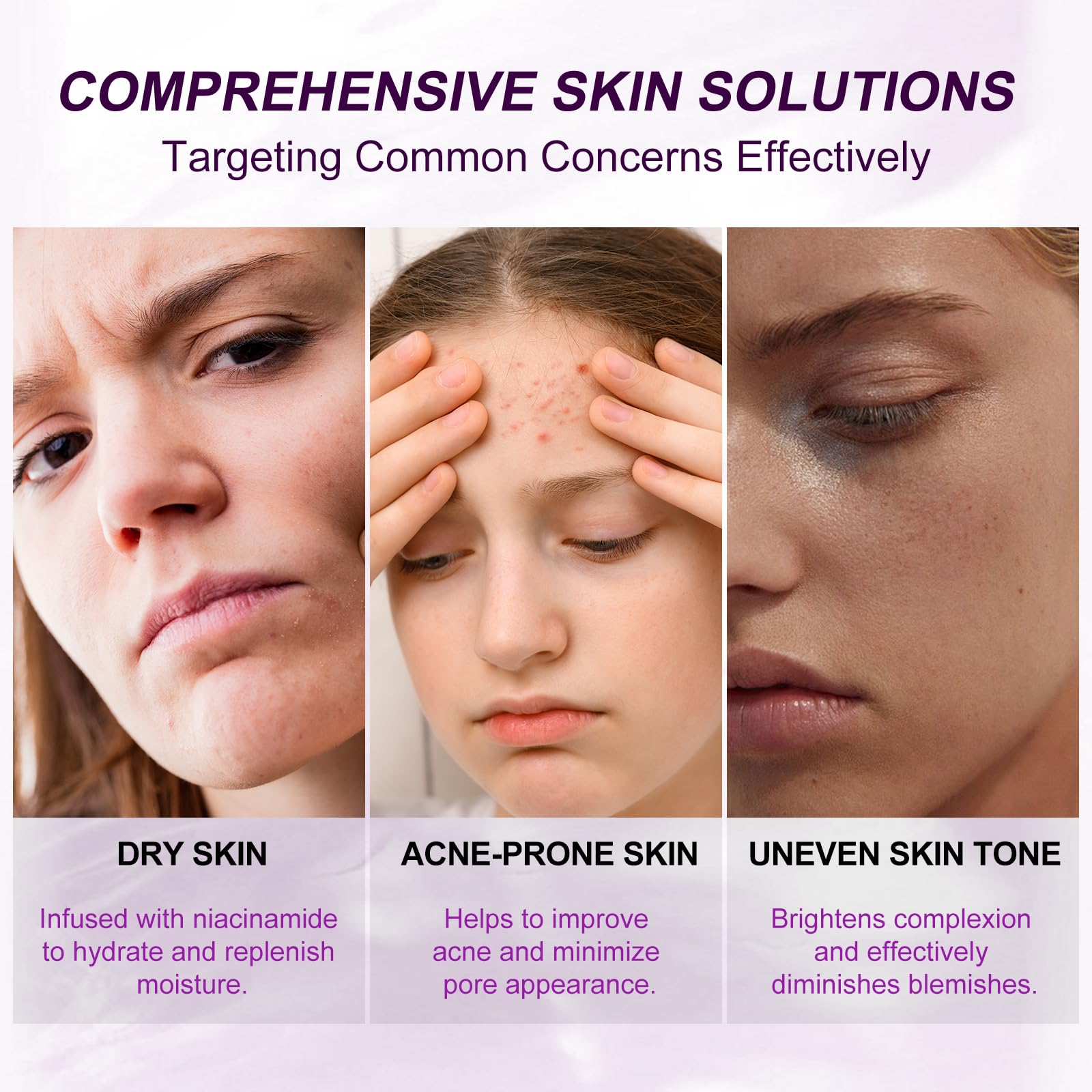 Marianp Hyaluronic Acid Serum for Face- Azelaic Acid 10% Serum for Facial And Skin Care Treatment with Vitamin B3 And B5 for Acne Pimple Pigmentation Blackhead Rosacea Beauty Skincare